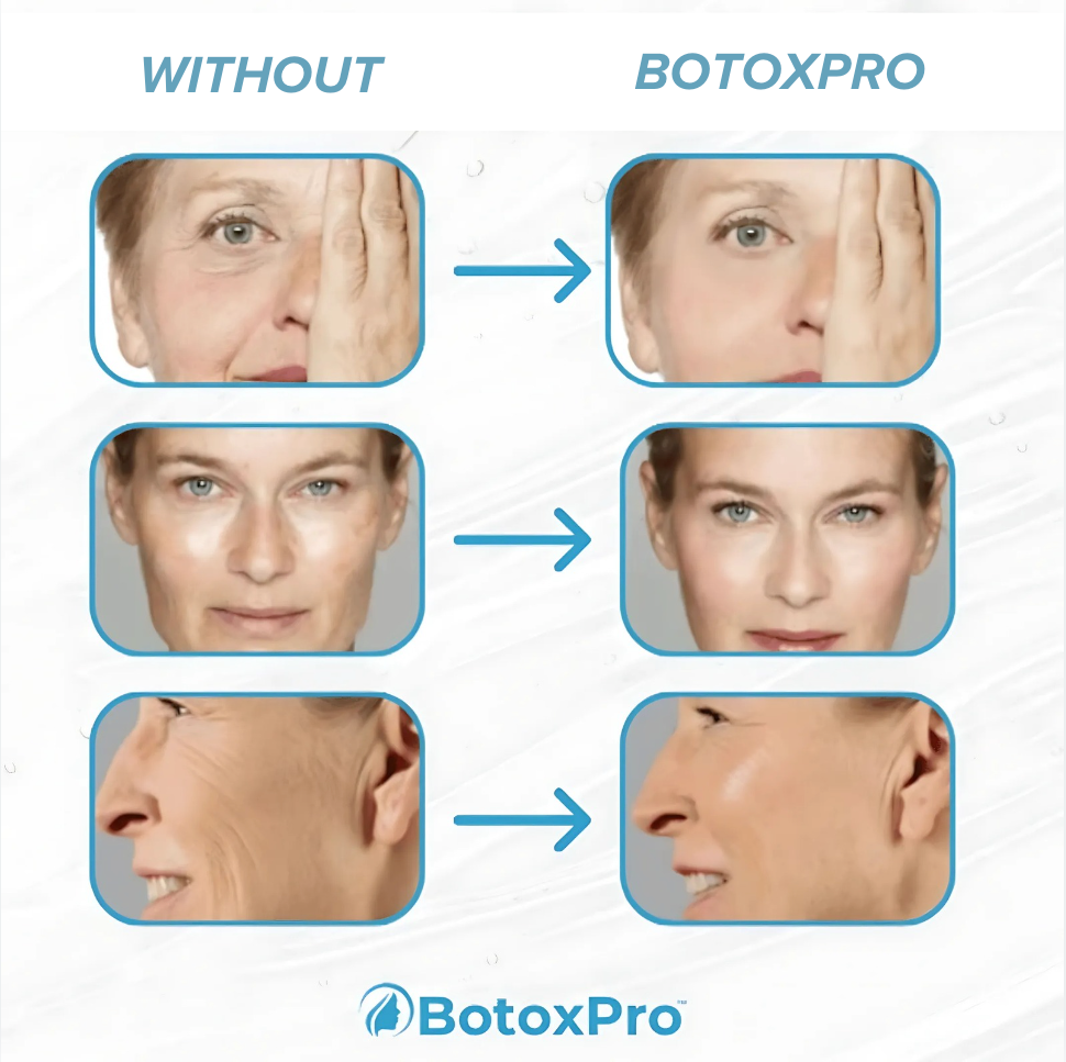 Smooth Young Fresh Baby Skin with BotoxPro the new liquid stem cell Botox in a bottle!