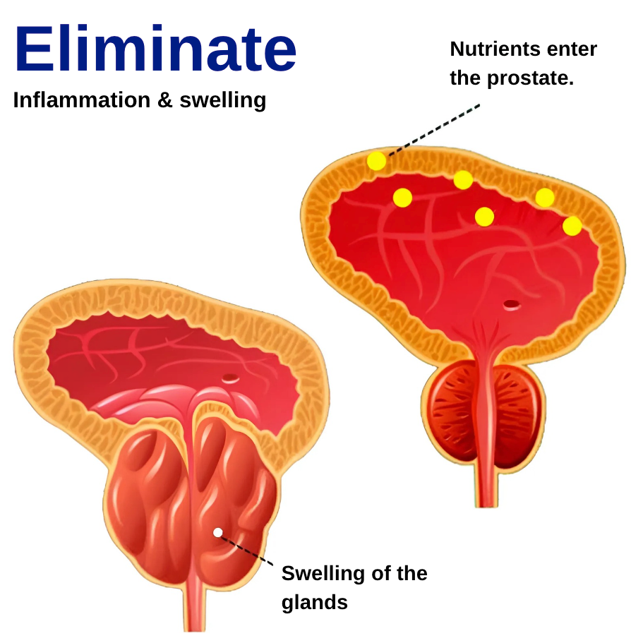 Quiel® cures 99% of prostate pain in the first week of use