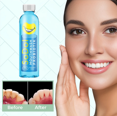 FreshDent™ Mouthwash