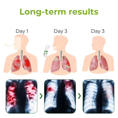 OxyBoost® - Lung Recovery Spray | Improve breathing by 93% in 7 days!